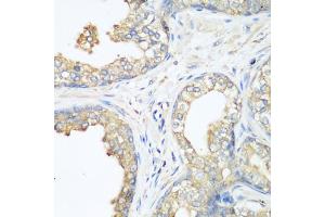 Immunohistochemistry of paraffin-embedded human prostate using CBL antibody. (CBL 抗体)