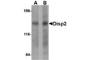 Image no. 1 for anti-Dispatched Homolog 2 (DISP2) (C-Term) antibody (ABIN341692) (DISP2 抗体  (C-Term))
