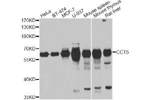 Western blot analysis of extracts of various cell lines, using CCT5 antibody (ABIN5973932) at 1/1000 dilution. (CCT5 抗体)