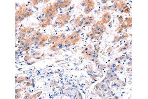 Immunohistochemistry (IHC) image for anti-C-Type Lectin Domain Family 4, Member D (CLEC4D) (AA 39-215) antibody (ABIN6219759) (CLEC4D 抗体  (AA 39-215))