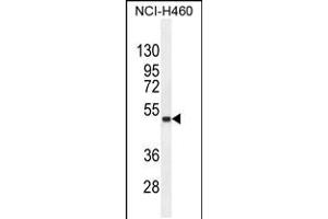 Western blot analysis in NCI-H460 cell line lysates (35ug/lane). (FNDC8 抗体  (AA 204-232))