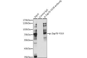 Immunoprecipitation analysis of 200 μg extracts of Jurkat cells, using 3 μg Phospho-Z-Y319 pAb (ABIN3023645, ABIN3023646, ABIN3023647, ABIN1682143 and ABIN1682144). (ZAP70 抗体  (pTyr319))