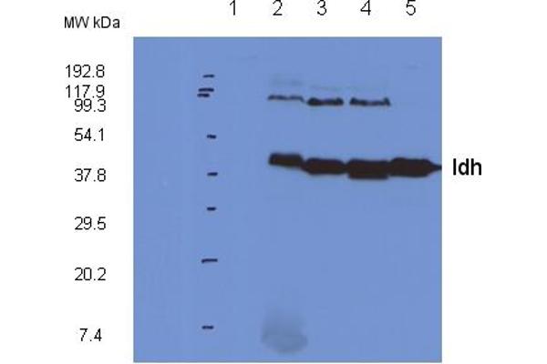 Isocitrate Dehydrogenase 抗体