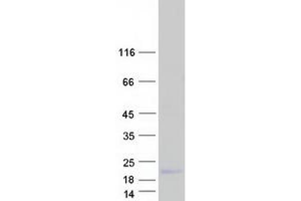 FXYD2 Protein (Transcript Variant C) (Myc-DYKDDDDK Tag)