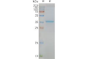 Human -Nanodisc, Flag Tag on SDS-PAGE (MLC1 蛋白)