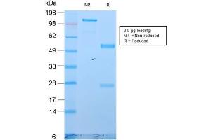 SDS-PAGE (SDS) image for anti-Keratin 18 (KRT18) antibody (ABIN6939939)