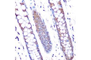 Immunohistochemistry of paraffin-embedded human colon using SKP2 Rabbit mAb (ABIN1680764, ABIN3018459, ABIN3018460 and ABIN7101615) at dilution of 1:100 (40x lens). (SKP2 抗体)