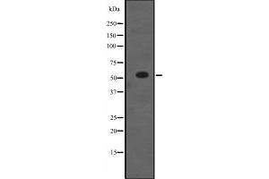 Western blot analysis of NR5A1 expression in HEK293 cells ,The lane on the left is treated with the antigen-specific peptide. (NR5A1 抗体  (Internal Region))