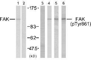 Western blot analysis using FAK (Ab-861) antibody (#B7082, Line 1 and 2) and FAK (phospho-Tyr861) antibody (#11059, Line 3, 4, 5 and 6). (FAK 抗体  (Tyr861))