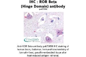 Image no. 1 for anti-RAR-Related Orphan Receptor B (RORB) antibody (ABIN1738925) (RORB 抗体)