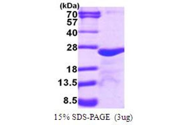 MYL5 Protein (AA 1-173) (His tag)