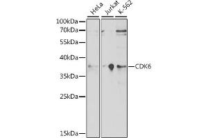 CDK6 抗体  (AA 1-326)