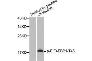 Western Blotting (WB) image for anti-Eukaryotic Translation Initiation Factor 4E Binding Protein 1 (EIF4EBP1) (pThr45) antibody (ABIN1870151) (eIF4EBP1 抗体  (pThr45))