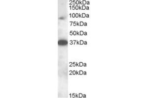 Western Blotting (WB) image for anti-Membrane-Associated Ring Finger (C3HC4) 10, E3 Ubiquitin Protein Ligase (MARCH10) (Internal Region) antibody (ABIN2466780) (MARCH10 抗体  (Internal Region))