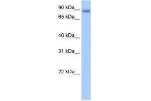 JAKMIP1 antibody used at 0. (JAKMIP1 抗体  (Middle Region))