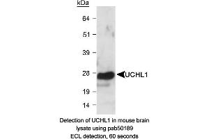 Image no. 1 for anti-Ubiquitin Carboxyl-terminal Esterase L1 (Ubiquitin Thiolesterase) (UCHL1) (AA 100-200) antibody (ABIN363498) (UCHL1 抗体  (AA 100-200))