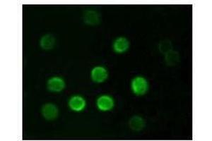 Immunofluorescence analysis of B lymphocytes using CD20 antibody. (CD20 抗体)