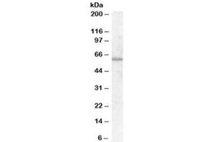 Western blot testing of HepG2 cell lysate with FZD7 antibody at 0. (FZD7 抗体)