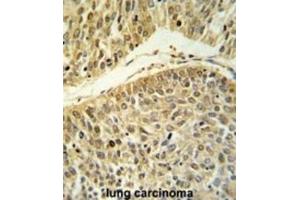 Immunohistochemistry (IHC) image for anti-Arginine-Glutamic Acid Dipeptide (RE) Repeats (RERE) antibody (ABIN3004391) (RERE 抗体)