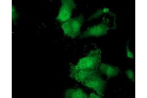 Anti-MOBKL2B mouse monoclonal antibody (ABIN2453315) immunofluorescent staining of COS7 cells transiently transfected by pCMV6-ENTRY MOBKL2B (RC205977). (MOBKL2B 抗体)