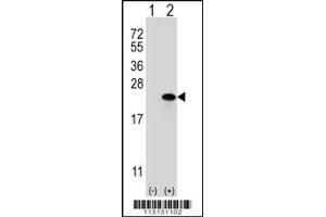 Western blot analysis of CLDN1 (arrow) using rabbit polyclonal CLDN1 Antibody (Loop2) (ABIN390290 and ABIN2840729). (Claudin 1 抗体  (AA 122-163))
