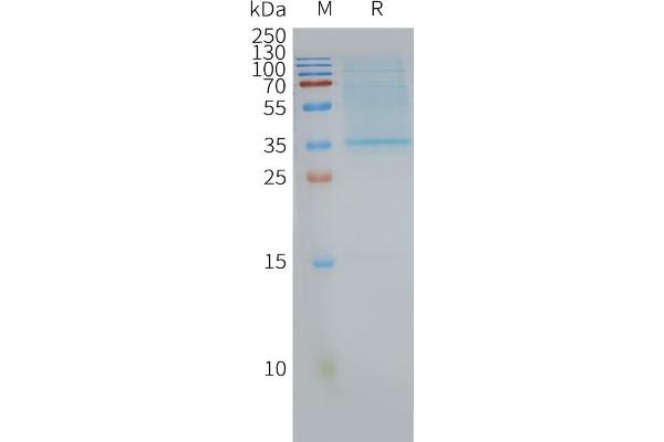 CD63 Protein (CD63)