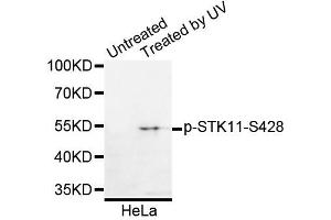 Western blot analysis of extracts of HeLa cells, using Phospho-STK11-S428 antibody. (LKB1 抗体  (pSer428))