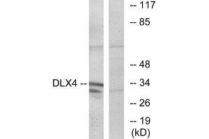 Western Blotting (WB) image for anti-Distal-Less Homeobox 4 (DLX4) (Internal Region) antibody (ABIN1849866) (DLX4 抗体  (Internal Region))