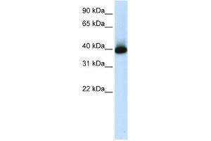 WB Suggested Anti-GSH2 Antibody Titration:  1. (GSX2 抗体  (C-Term))