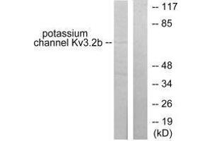 Western blot analysis of extracts from HepG2 cells, using Potassium Channel Kv3. (KCNC2 抗体)