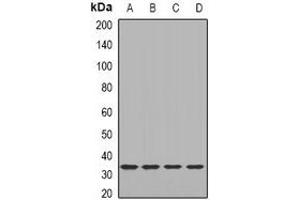 Western blot analysis of LACI expression in HEK293T (A), MCF7 (B), mouse lung (C), mouse heart (D) whole cell lysates. (LacI 抗体)