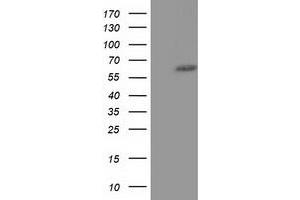 HEK293T cells were transfected with the pCMV6-ENTRY control (Left lane) or pCMV6-ENTRY KLHL2 (Right lane) cDNA for 48 hrs and lysed. (KLHL2 抗体  (AA 1-100, AA 494-593))