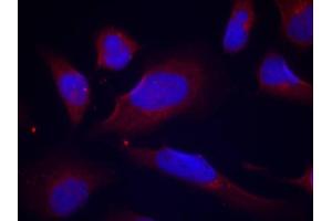 Immunofluorescence staining of methanol-fixed HeLa cells using Phospho-NOS3-S1177 antibody (ABIN2988223). (ENOS 抗体  (pSer1177))