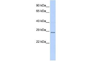TFPI2 antibody used at 1 ug/ml to detect target protein. (TFPI2 抗体  (Middle Region))
