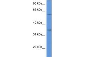 Image no. 1 for anti-CD34 (CD34) (AA 188-237) antibody (ABIN6746929) (CD34 抗体  (AA 188-237))