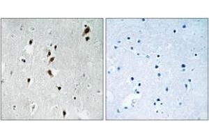 Immunohistochemistry analysis of paraffin-embedded human brain, using Mnk1 (Phospho-Thr385) Antibody. (MKNK1 抗体  (pThr385))