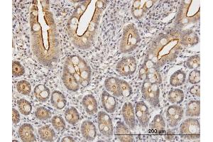 Immunoperoxidase of purified MaxPab antibody to KLK2 on formalin-fixed paraffin-embedded human small Intestine. (Kallikrein 2 抗体  (AA 1-223))