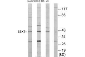 Western blot analysis of extracts from HepG2/Jurkat/COLO205 cells, using SSXT Antibody. (SS18 抗体  (AA 1-50))