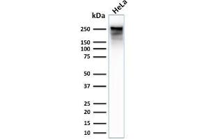 Western Blotting (WB) image for anti-Spectrin, Beta, Non-erythrocytic 2 (SPTBN2) (AA 356-475) antibody (ABIN6940657)