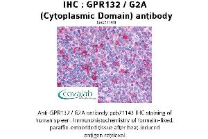 Image no. 1 for anti-G Protein-Coupled Receptor 132 (GPR132) (2nd Cytoplasmic Domain) antibody (ABIN1734928) (G Protein-Coupled Receptor 132 抗体  (2nd Cytoplasmic Domain))