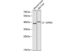 Western blot analysis of extracts of various cell lines using GPR55 Polyclonal Antibody at dilution of 1:3000. (GPR55 抗体)