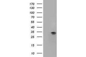 Western Blotting (WB) image for anti-Four and A Half LIM Domains 1 (FHL1) antibody (ABIN1500974) (FHL1 抗体)