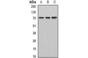 Western blot analysis of CKAP4 expression in HepG2 (A), MCF7 (B), mouse testis (C) whole cell lysates. (CKAP4 抗体)