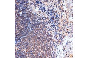 Immunohistochemistry of paraffin-embedded rat spleen using FNTB Rabbit mAb (ABIN1680761, ABIN3016316, ABIN3016317 and ABIN7101479) at dilution of 1:100 (40x lens). (FNTB 抗体)