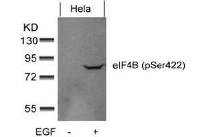 Image no. 2 for anti-Eukaryotic Translation Initiation Factor 4B (EIF4B) (pSer422) antibody (ABIN401564) (EIF4B 抗体  (pSer422))