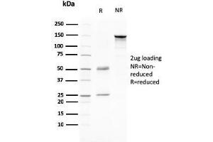 SDS-PAGE Analysis Purified CD80 Mouse Monoclonal Antibody (C80/2776). (CD80 抗体  (AA 35-142))