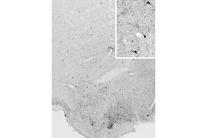 Immunohistochemistry (IHC) image for anti-Nitric Oxide Synthase 1, Neuronal (NOS1) (C-Term) antibody (ABIN184662)