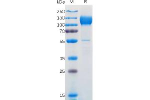 Human N Protein, hFc Tag on SDS-PAGE under reducing condition. (NTRK3 Protein (AA 32-429) (Fc Tag))