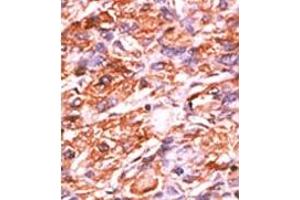 Image no. 2 for anti-Retinoblastoma 1 (RB1) (pSer811) antibody (ABIN358217) (Retinoblastoma 1 抗体  (pSer811))