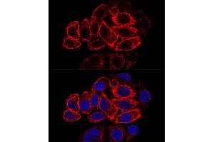 Confocal immunofluorescence analysis of HeLa cells using Cytokeratin 17 (KRT17) antibody (ABIN6130112, ABIN6143023, ABIN6143024 and ABIN6213626) at dilution of 1:200. (KRT17 抗体  (AA 133-432))